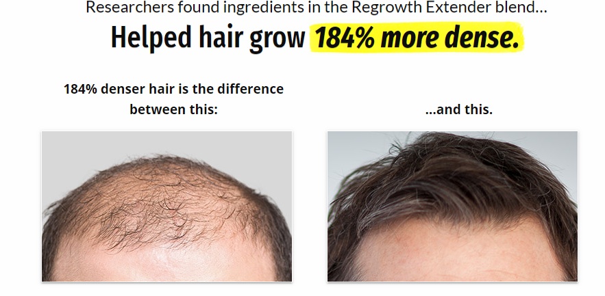 Best Hair Loss Treatments for Men: Proven Ways To Regrow Hair